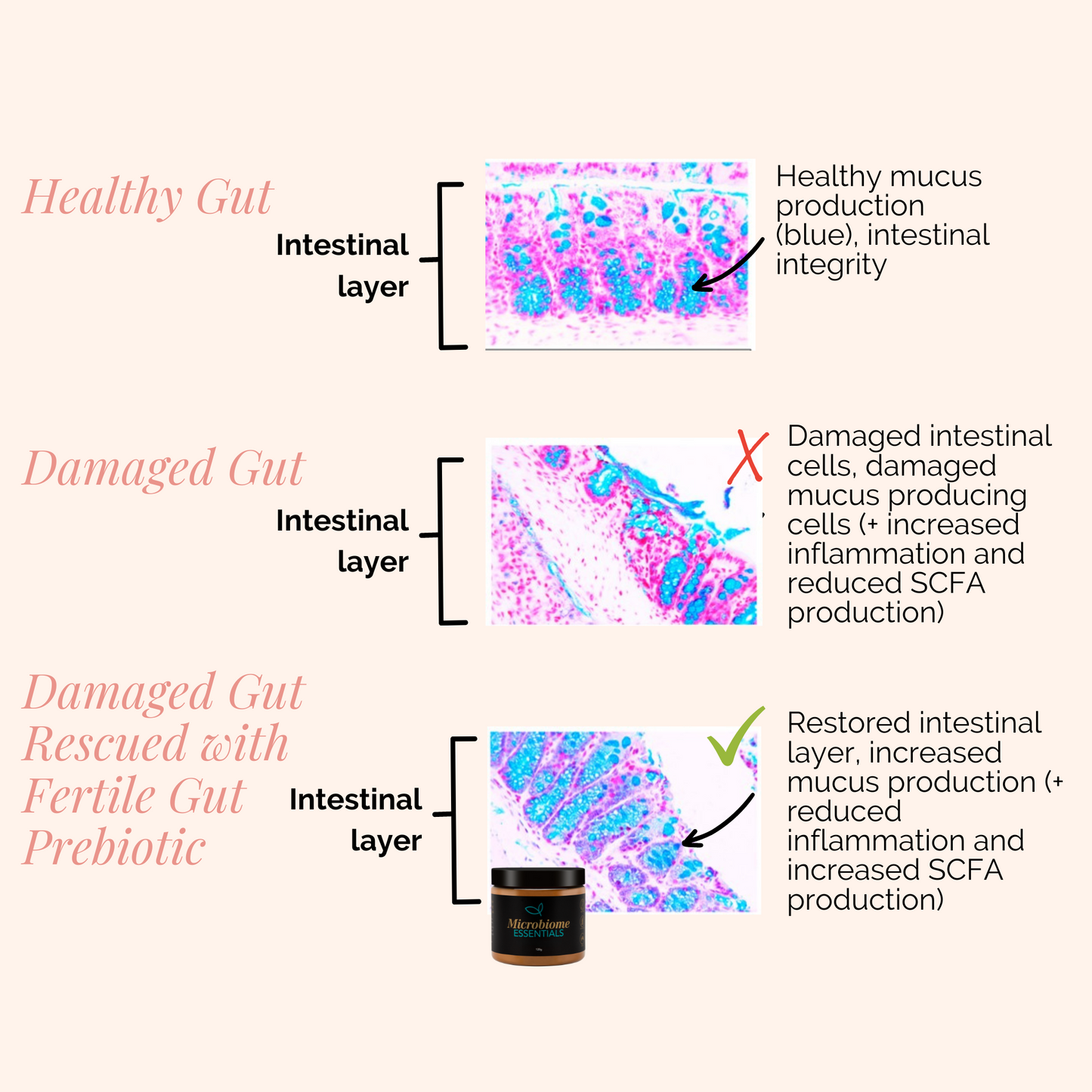 Microbiome Essentials